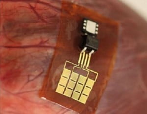 Công nghệ cấy ghép thiết bị y khoa vào cơ thể không sử dụng pin