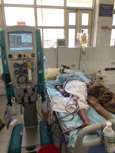 BỆNH VIỆN ĐA KHOA SƠN TÂY THỰC HIỆN THÀNH CÔNG CA THAY HUYẾT TƯƠNG HỖ TRỢ ĐIỀU TRỊ SUY GAN